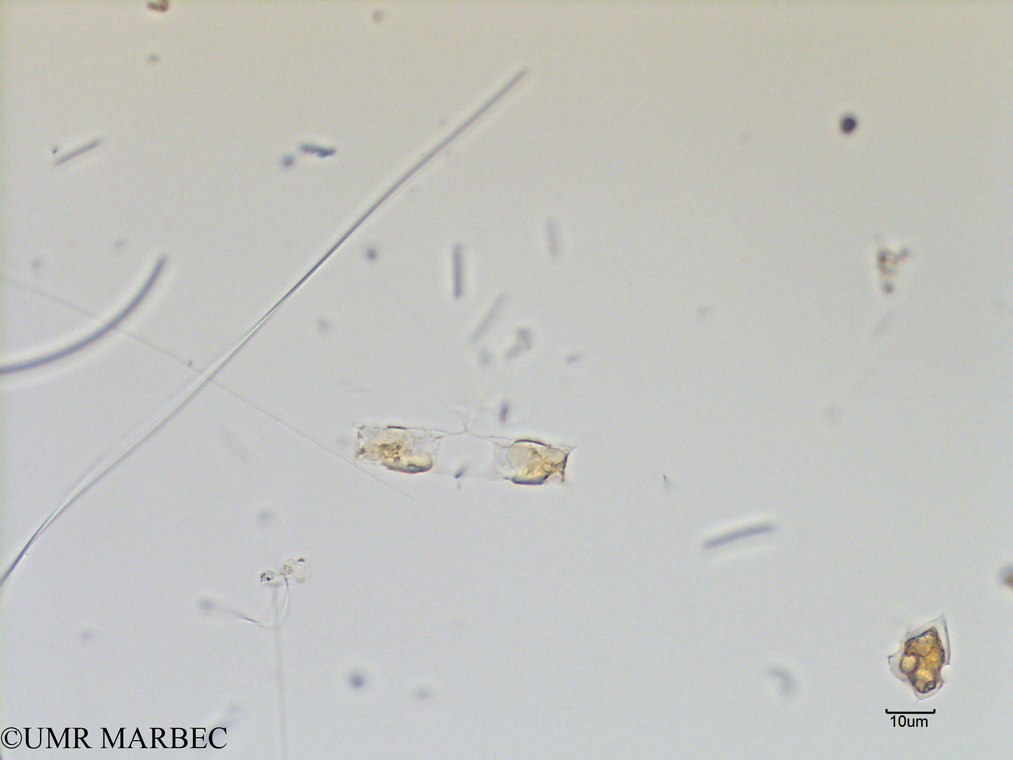 phyto/Scattered_Islands/mayotte_lagoon/SIREME May 2016/Chaetoceros distans (MAY5_chaetoceros b-7).tif(copy).jpg